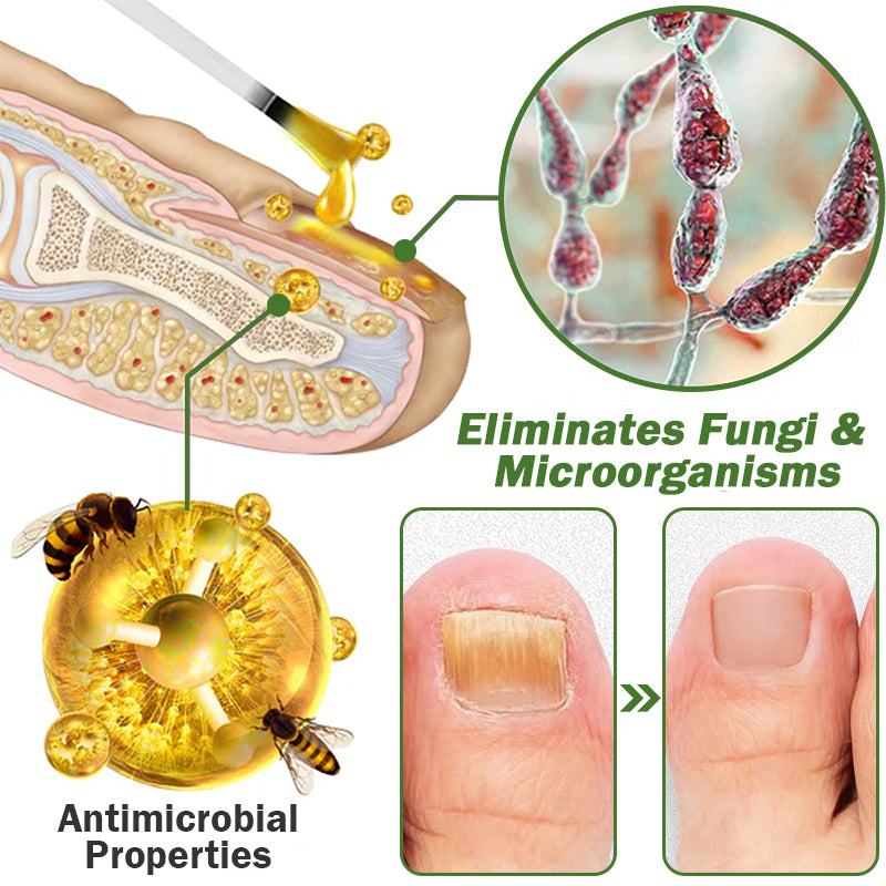 š¤ļøš©āāļøFurzero⢠Nail Defense Bee Venom Treatment Serum(For All Kinds Of Nail Diseasesā
For Healthier Nail Growth)
