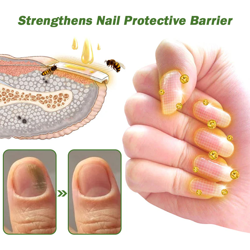š¤ļøš©āāļøFurzero⢠Nail Defense Bee Venom Treatment Serum(For All Kinds Of Nail Diseasesā
For Healthier Nail Growth)