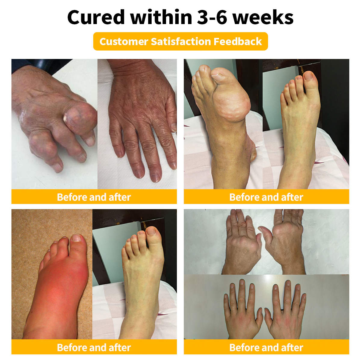 🌻Furzero™ Bee Venom Joint and Bone Cream (✨ Specially for orthopedic conditions and joint pain ✨)